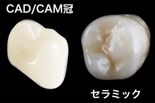 CAD/CAM冠とセラミック