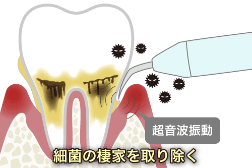 通常のスケーリング