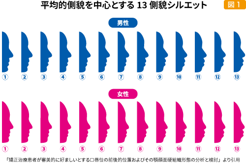 平均的側貌を中心とする13側貌シルエット