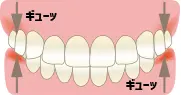 クレンチングのイメージイラスト