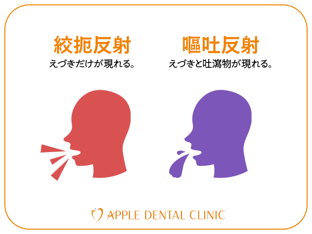 絞扼反射が起こる身体的・心理的な原因を示したイラスト