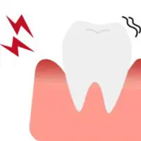 歯茎の炎症