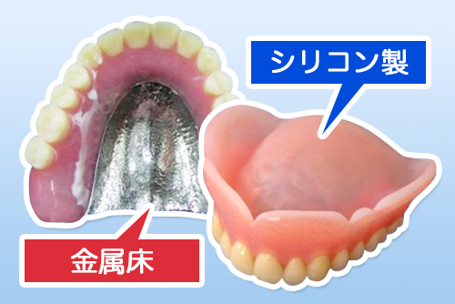精密入れ歯の種類